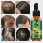 king of ginger hair growth serum germinal oil 30ml pinoyhyper 4