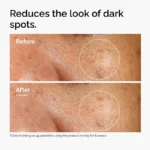 ord alpha arbutin before after dark spots