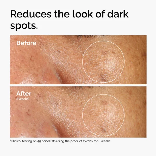 ord alpha arbutin before after dark spots