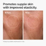 ord hyaluronic acid 2pct b5 hydrating serum before after elasticity