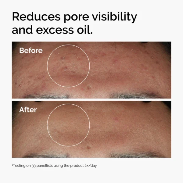 ord niacinamide zinc blemish serum before after pores