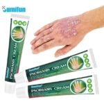 كريم الصدفية لتخفيف الحكة والاحمرار وترطيب الجلد Psoriasis Cream