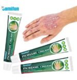 كريم الصدفية لتخفيف الحكة والاحمرار وترطيب الجلد Psoriasis Cream